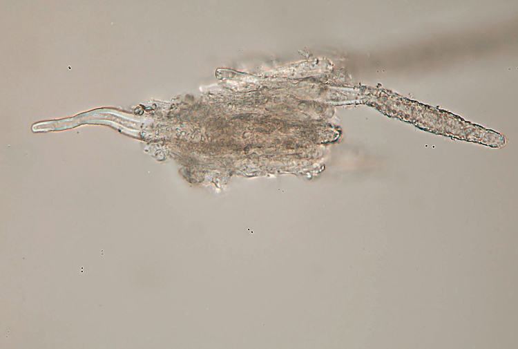 Sullo stesso tronco (Phlebiopsis ravenelii)